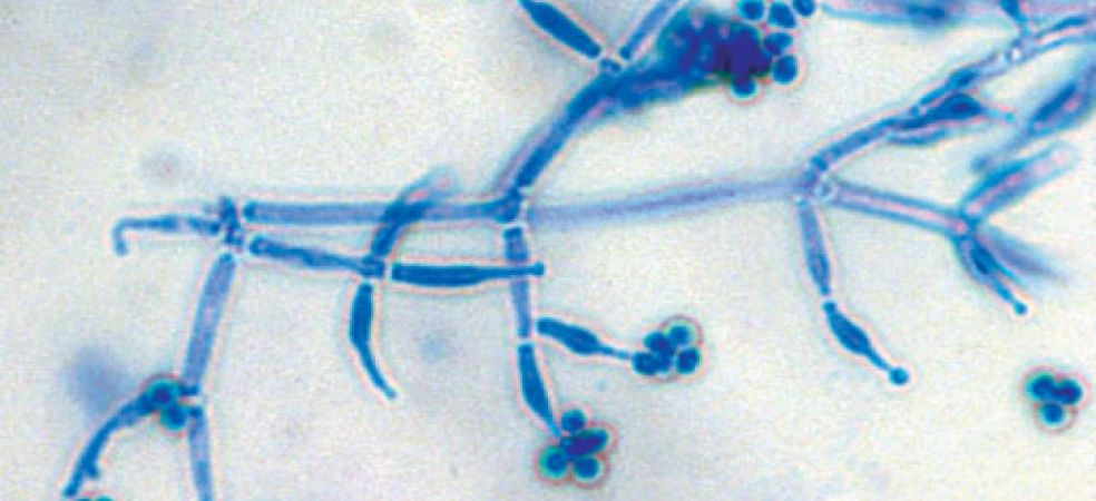 Trichoderma's importance in agriculture